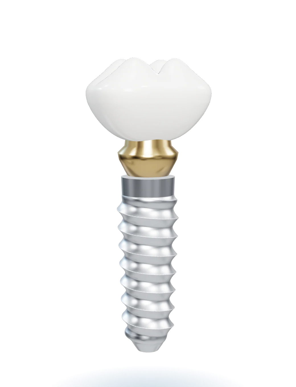 Ceramic crown, Abutment, Titanium implant